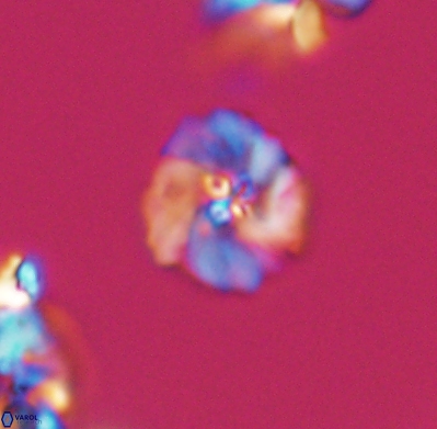 Pickelhaube umbellatum 11646