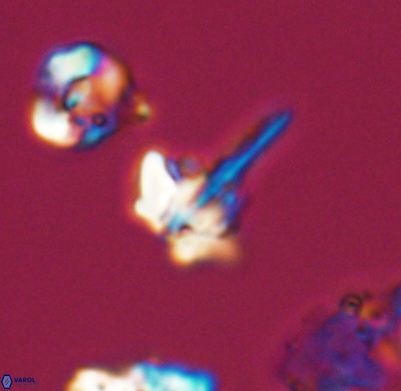 Pickelhaube umbellatum 11677