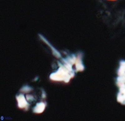 Pickelhaube umbellatum 11673