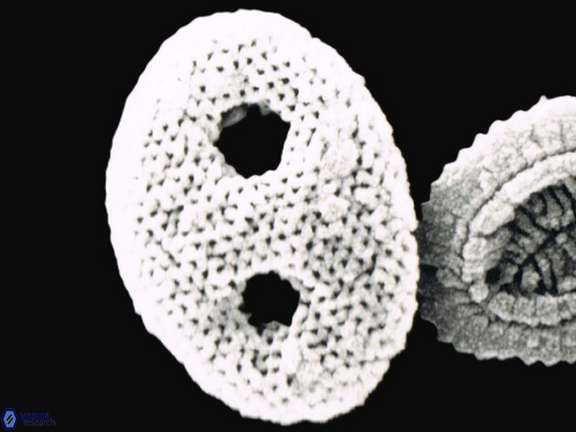 Ponticulofera 1