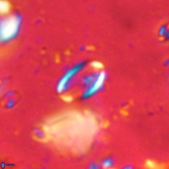 Pontosphaera alabamaensis VR 00489