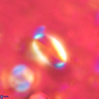 Pontosphaera alabamaensis VR 00496