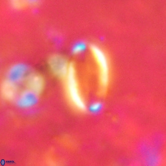 Pontosphaera alabamaensis VR 00499