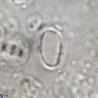 Pontosphaera alabamaensis VR 00506