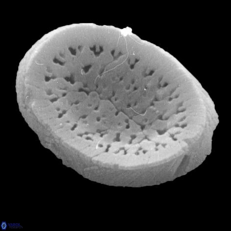 Pontosphaera geminiporus 1 943 11