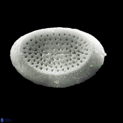 Pontosphaera discopora 1 1133 17
