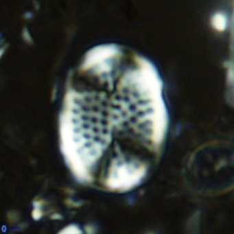 Pontosphaera discopora VR 07929