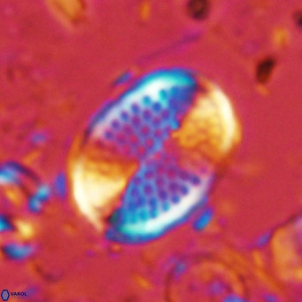 Pontosphaera discopora VR 07934
