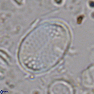 Pontosphaera discopora VR 07935