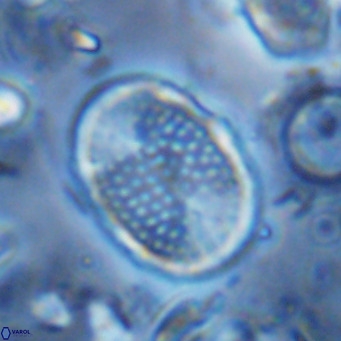 Pontosphaera discopora VR 07939