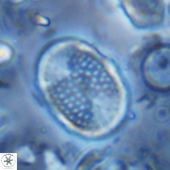 Pontosphaera discopora VR 07939