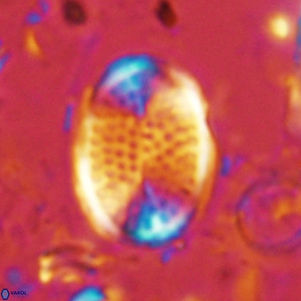 Pontosphaera discopora VR 07930