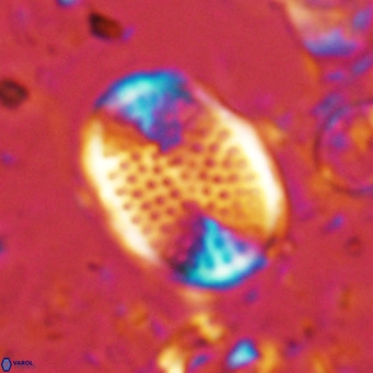 Pontosphaera discopora VR 07931