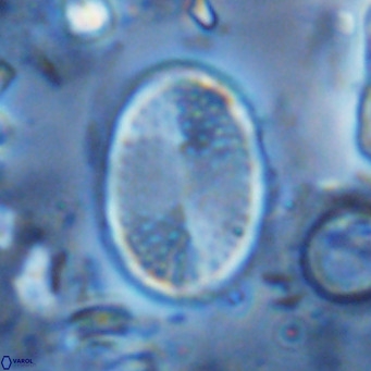 Pontosphaera discopora VR 07940