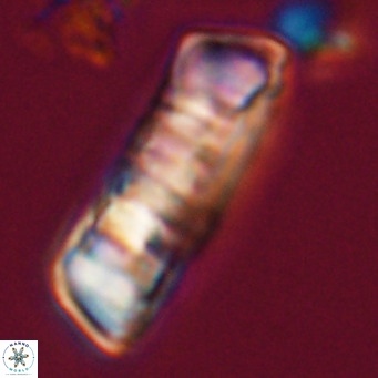 Pontosphaera distincta VR 31282