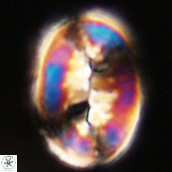 Pontosphaera distincta VR 31298