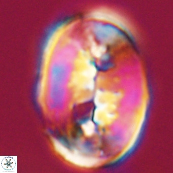 Pontosphaera distincta VR 31299