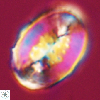 Pontosphaera distincta VR 31304