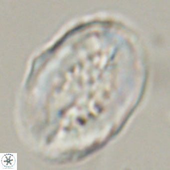 Pontosphaera distincta VR 31306