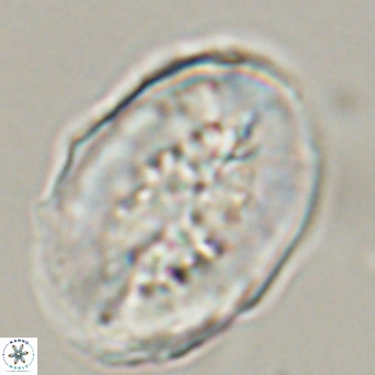 Pontosphaera distincta VR 31307