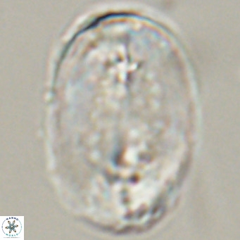 Pontosphaera distincta VR 31308