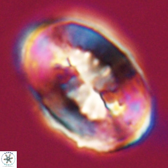 Pontosphaera distincta VR 31300