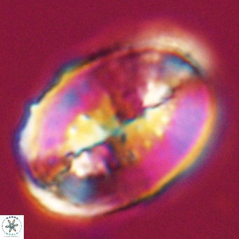 Pontosphaera distincta VR 31303