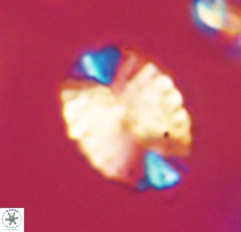 Pontosphaera ovata VR 32374