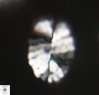 Pontosphaera ovata VR 32376