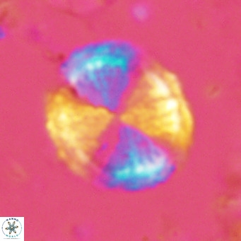 Pontosphaera lepida VR 06485