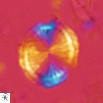 Pontosphaera lepida VR 06486