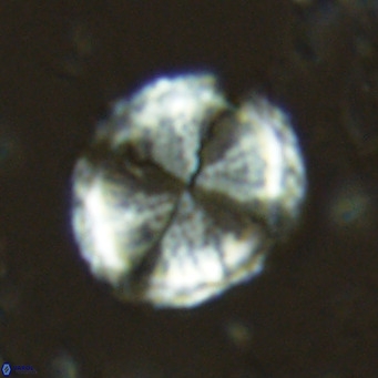 Pontosphaera lepida VR 06489