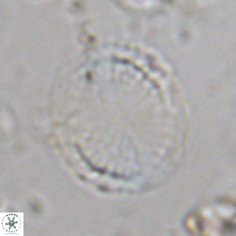 Pontosphaera lepida VR 06494