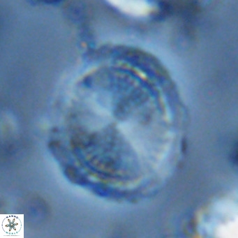 Pontosphaera lepida VR 06495
