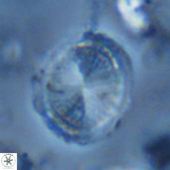 Pontosphaera lepida VR 06496
