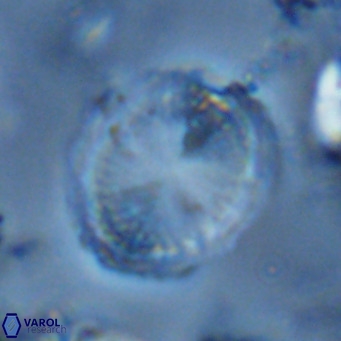 Pontosphaera lepida VR 06497