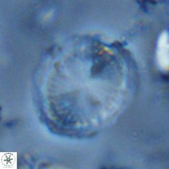 Pontosphaera lepida VR 06497