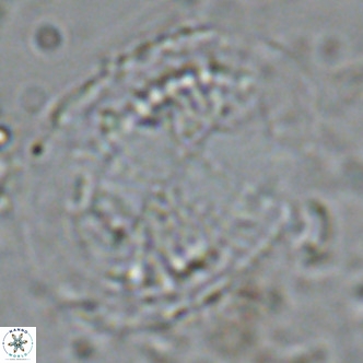 Pontosphaera lepida VR 08998