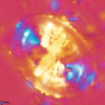 Pontosphaera lepida VR 08992