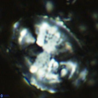 Pontosphaera lepida VR 08993
