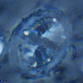 Pontosphaera lepida VR 09004