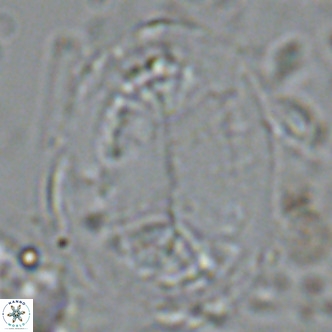 Pontosphaera lepida VR 09000