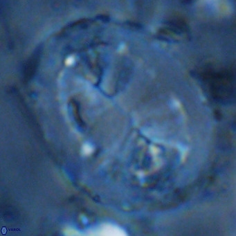 Pontosphaera lepida VR 09002