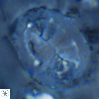 Pontosphaera lepida VR 09002