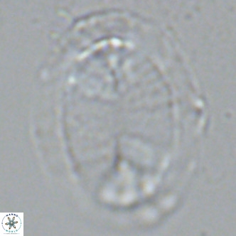 Pontosphaera lepida VR 09044