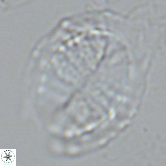 Pontosphaera lepida VR 09045