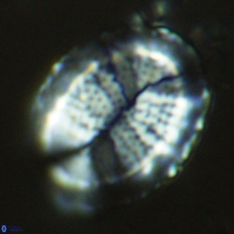 Pontosphaera lepida VR 09048