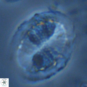 Pontosphaera lepida VR 09040