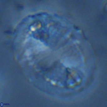Pontosphaera lepida VR 09042