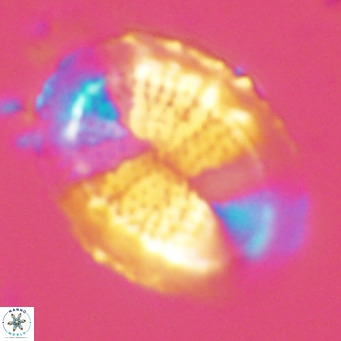 Pontosphaera lepida VR 09054